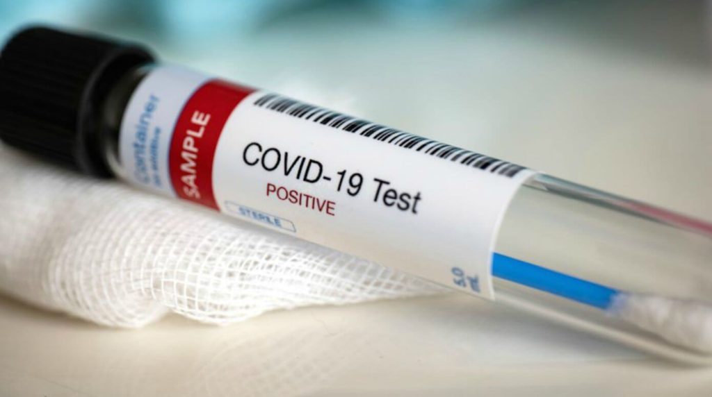 COVID-19 Testing in India_Featured Image