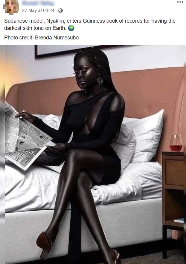 darkest skin tone