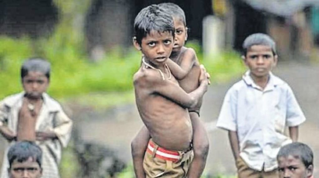 Malnutrition in Children_Featured Image
