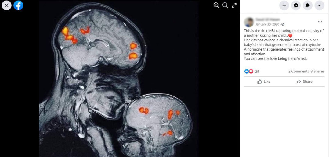 The activations in this MRI ‘have nothing to do with